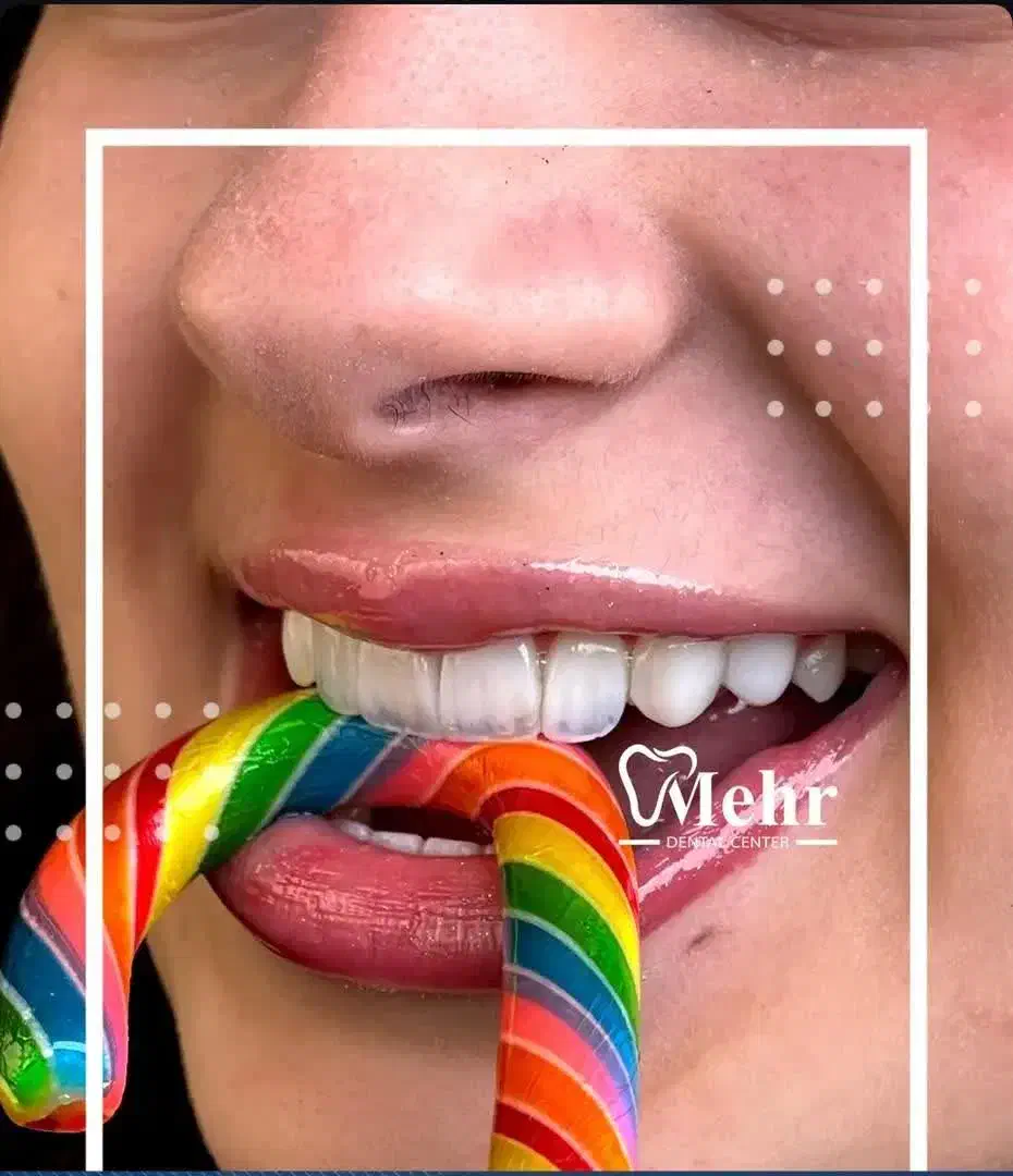 کامپوزیت هشت واحد فقط با ۵ تومان|خدمات آرایشگری و زیبایی|تهران, هفت حوض|دیوار