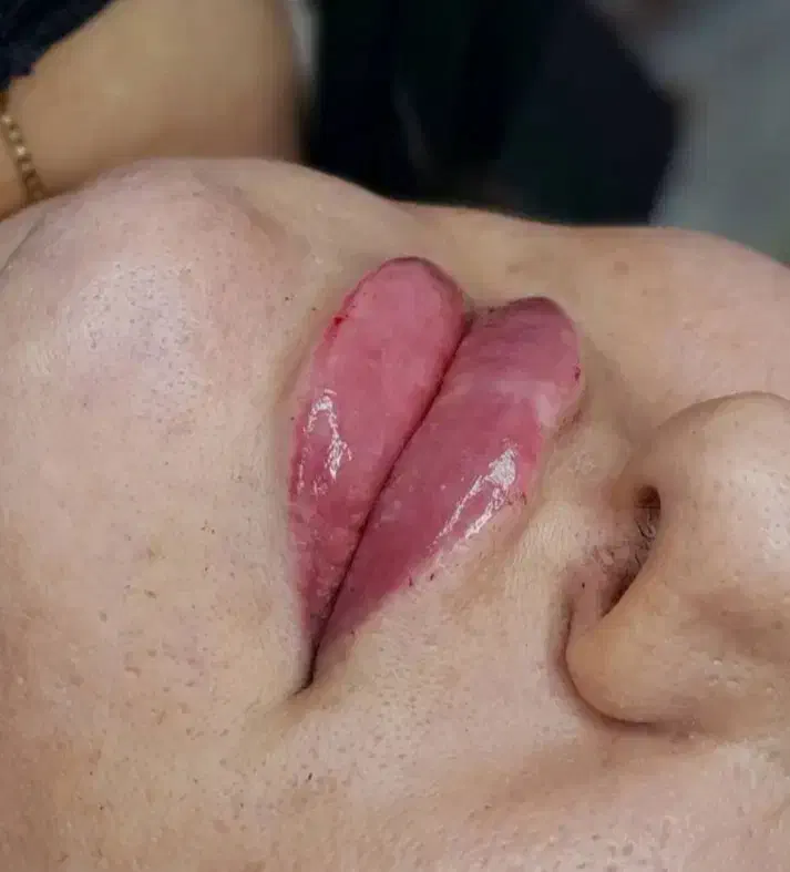 خدمات تزریق تخصصی ژل ،فیلر و بوتاکس و آنزیم|خدمات آرایشگری و زیبایی|سبزوار, جنت|دیوار