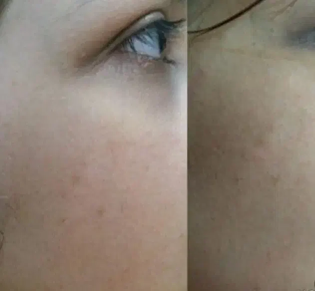 فروش خاویارحلزون درجه یک|آرایشی، بهداشتی، درمانی|رباط‌کریم, رباط‌کریم|دیوار