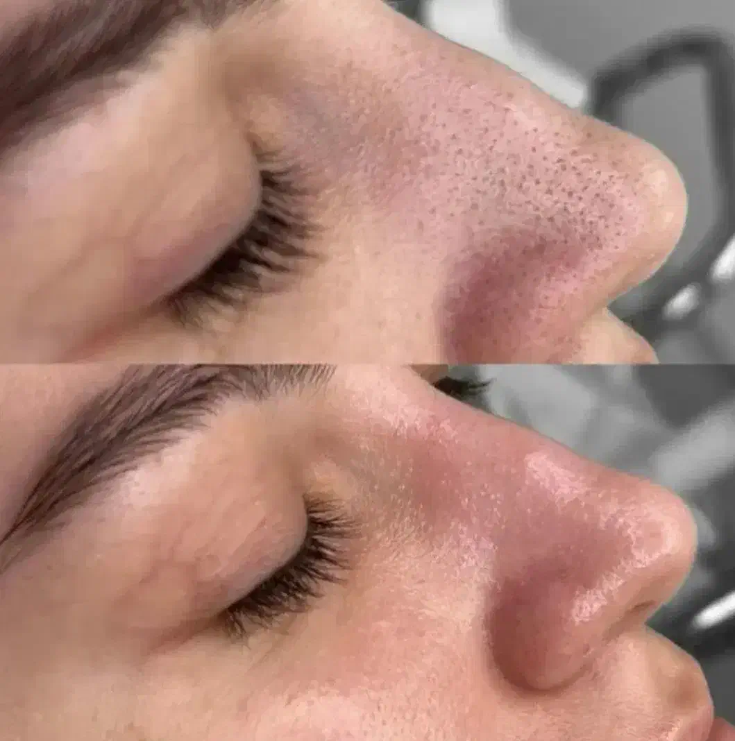 خدمات و اموزش فشیال (پاکسازی صورت)|خدمات آرایشگری و زیبایی|کرمانشاه, |دیوار