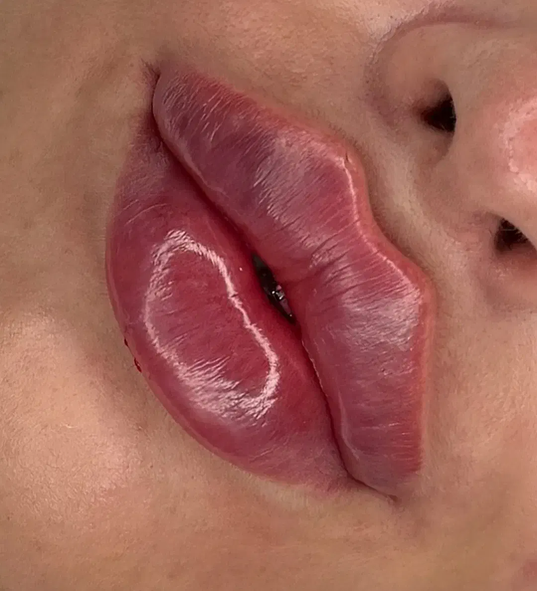 جشنواره ژل بوتاکس فیلر لیزرجوانسازمزو|خدمات آرایشگری و زیبایی|تبریز, |دیوار