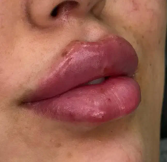 ژل فیلر بوتاکس آفر ویژه|خدمات آرایشگری و زیبایی|شیراز, سلطان آباد|دیوار