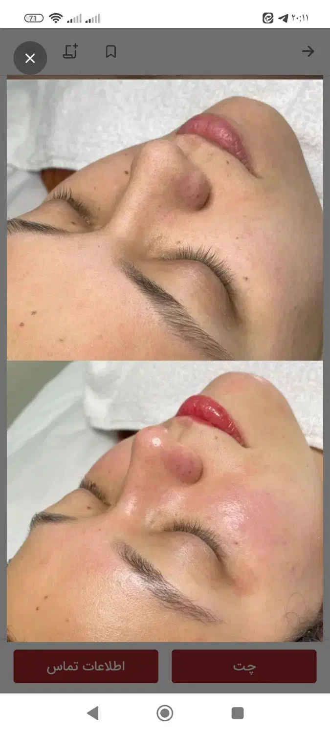 پاکسازی جوانسازی پوست صورت|خدمات آرایشگری و زیبایی|قم, شهرک امام حسن|دیوار