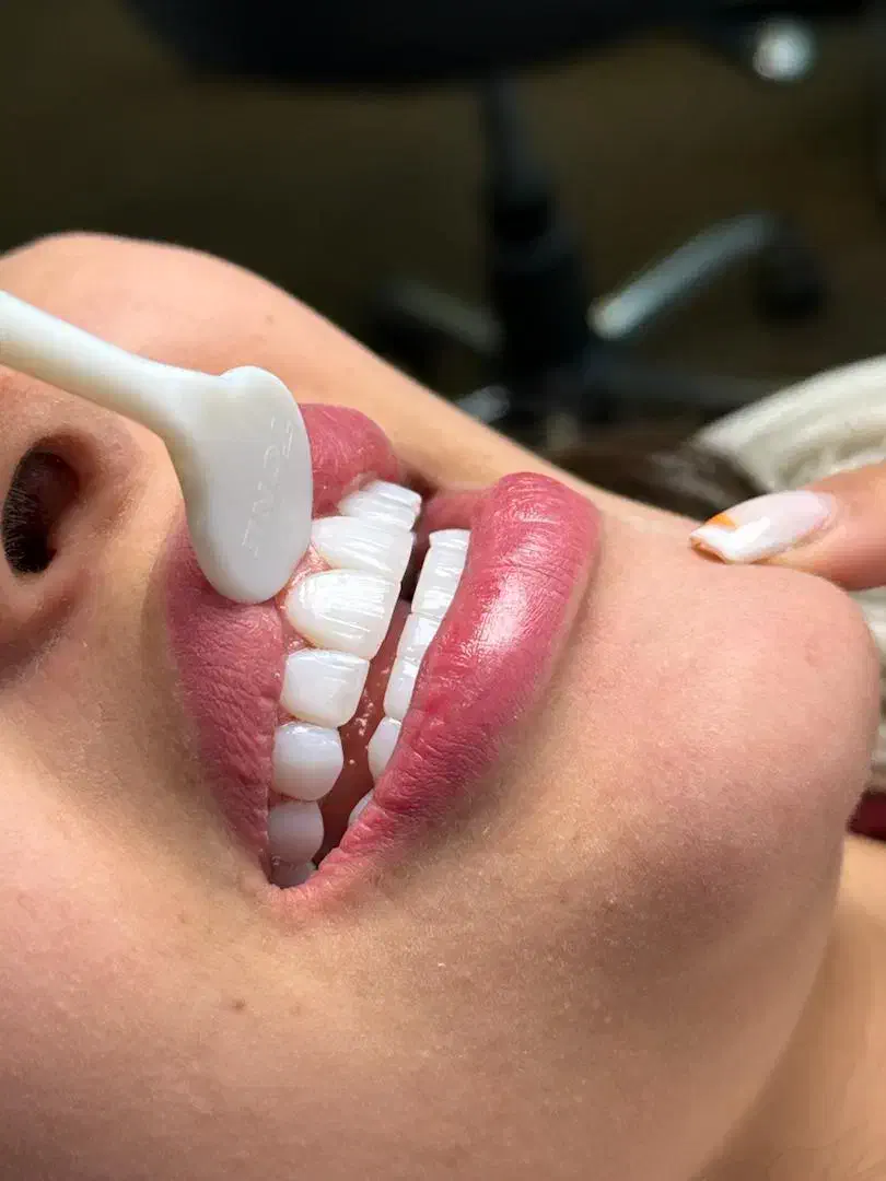 خدمات درمانی و زیبایی دندان|خدمات آرایشگری و زیبایی|کرمانشاه, |دیوار