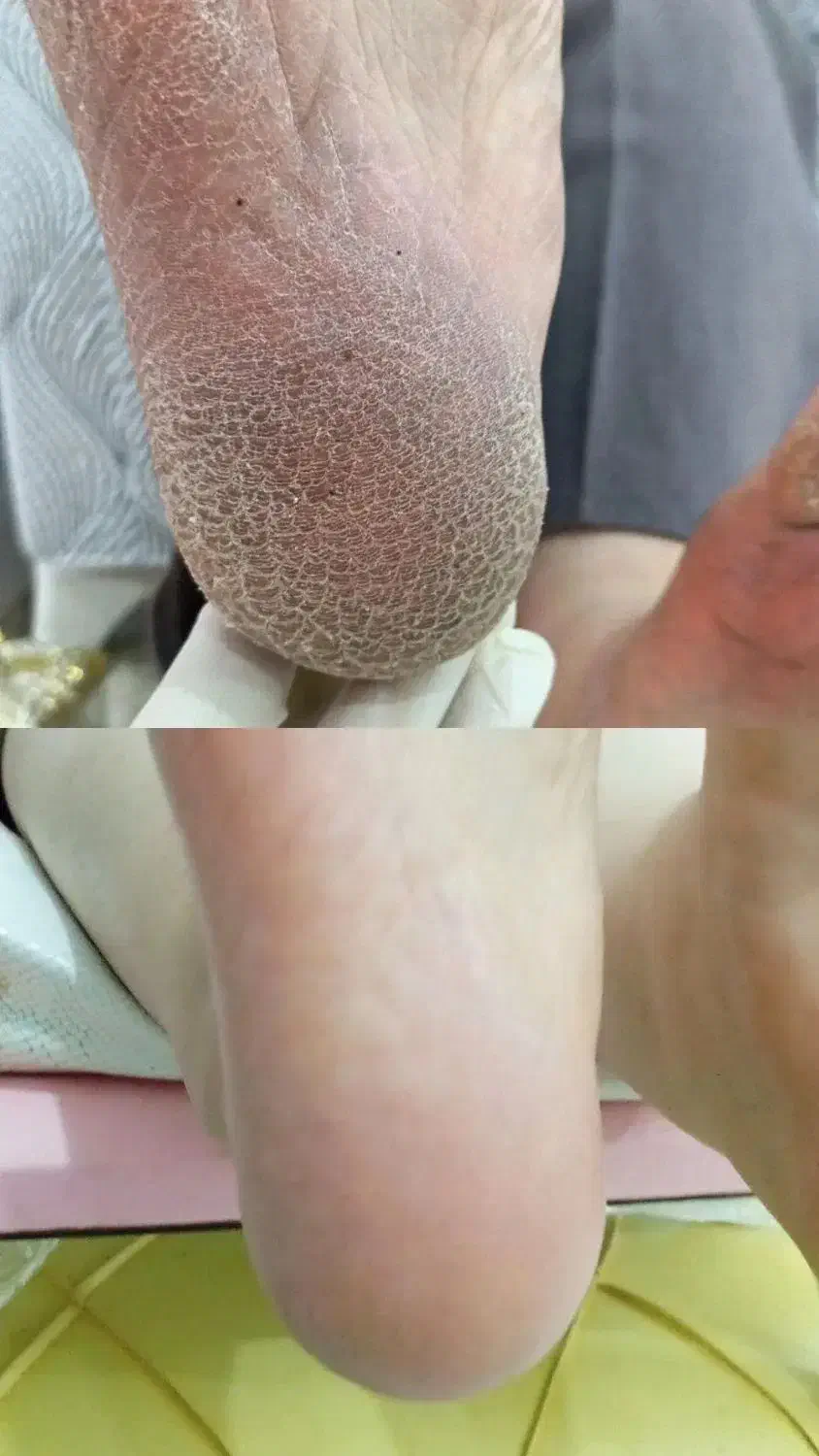 پدیکور  حرفه ای در مهاباد|خدمات آرایشگری و زیبایی|مهاباد (آذربایجان غربی), |دیوار