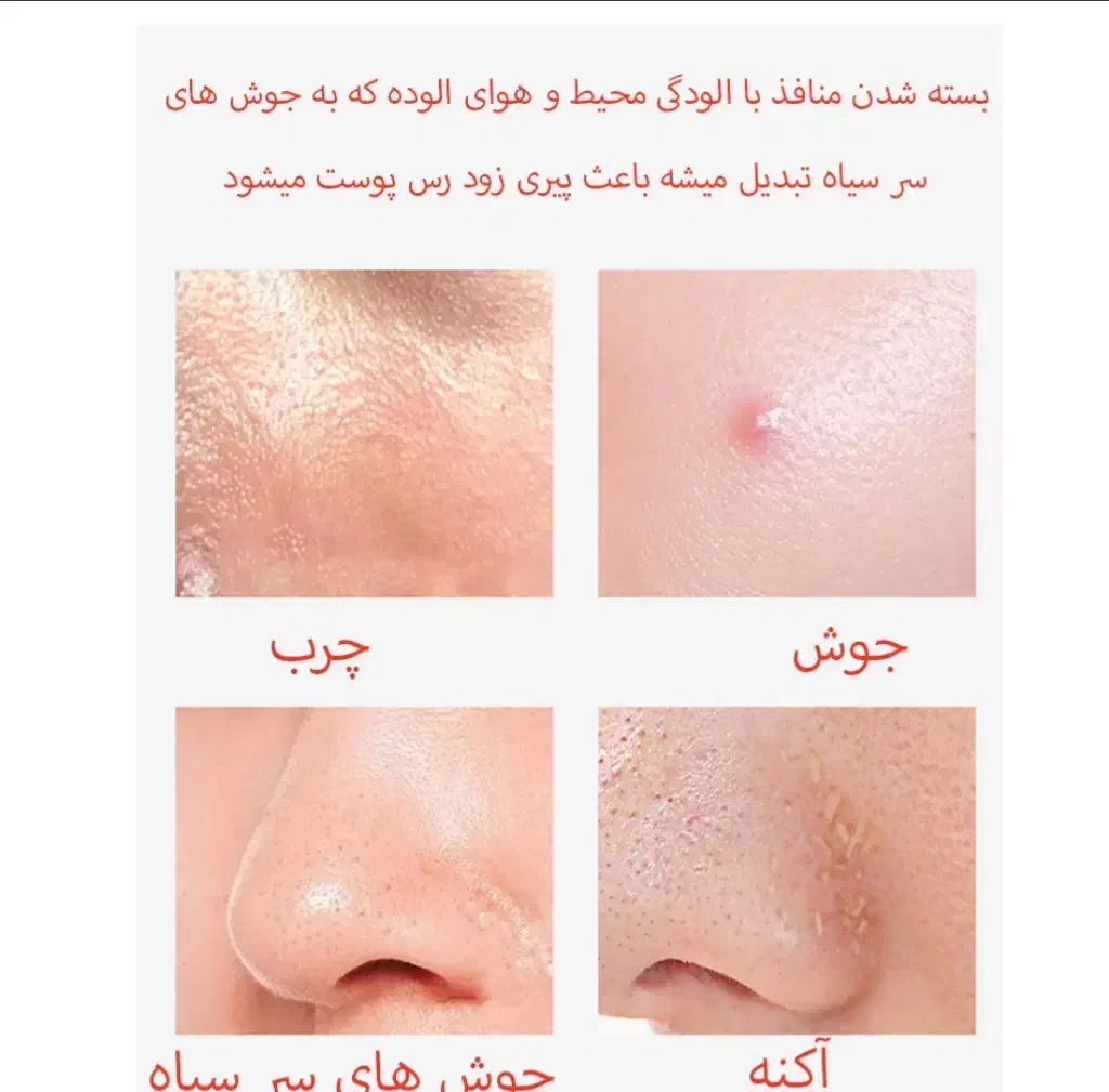 پاکسازی تخصصی پوست با متد درمانی نوین|خدمات آرایشگری و زیبایی|اهواز, شهرک برق|دیوار