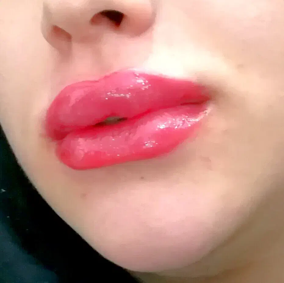 ژل و بوتاکس|خدمات آرایشگری و زیبایی|بروجرد, |دیوار