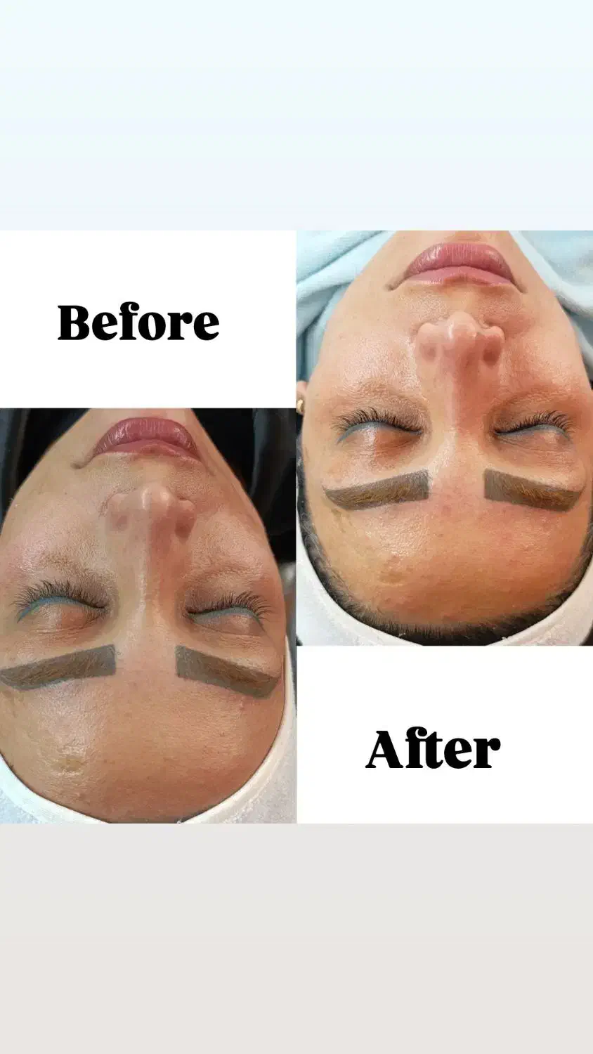 مدل فیشال رایگان|خدمات آرایشگری و زیبایی|علی‌آباد کتول, |دیوار