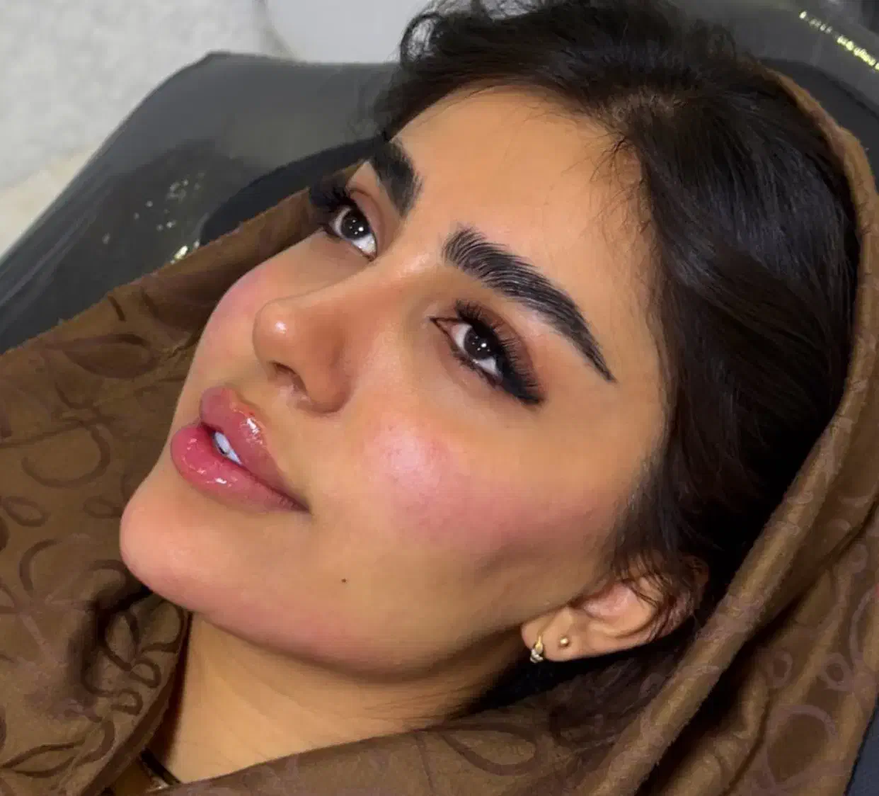 تزریق ژل لب بوتاکس مزو انزیم کانتورینگ لیفت صورت|خدمات آرایشگری و زیبایی|تهران, باغ فیض|دیوار