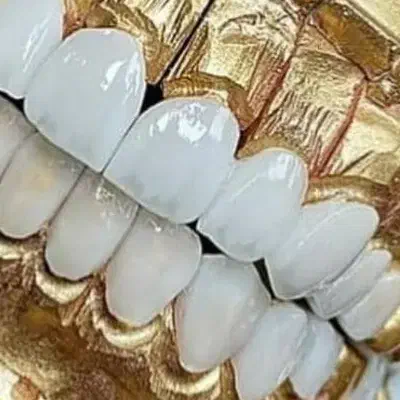 روکش تمام سرامیک ودندان مصنوعی|آرایشی، بهداشتی، درمانی|اندیمشک, |دیوار