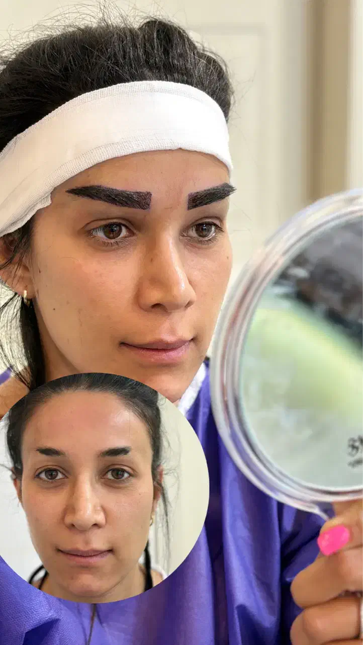 کاشت ابرو|خدمات آرایشگری و زیبایی|کرج, عظیمیه|دیوار