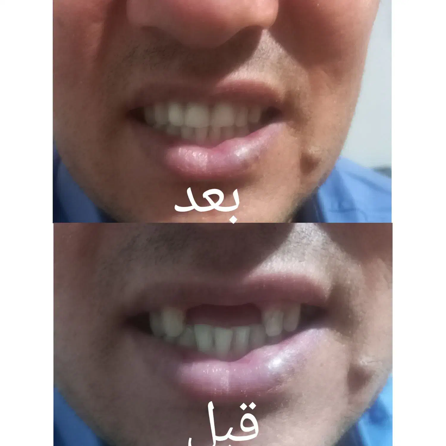 دندان سازی امانی|آرایشی، بهداشتی، درمانی|گنبد کاووس, |دیوار