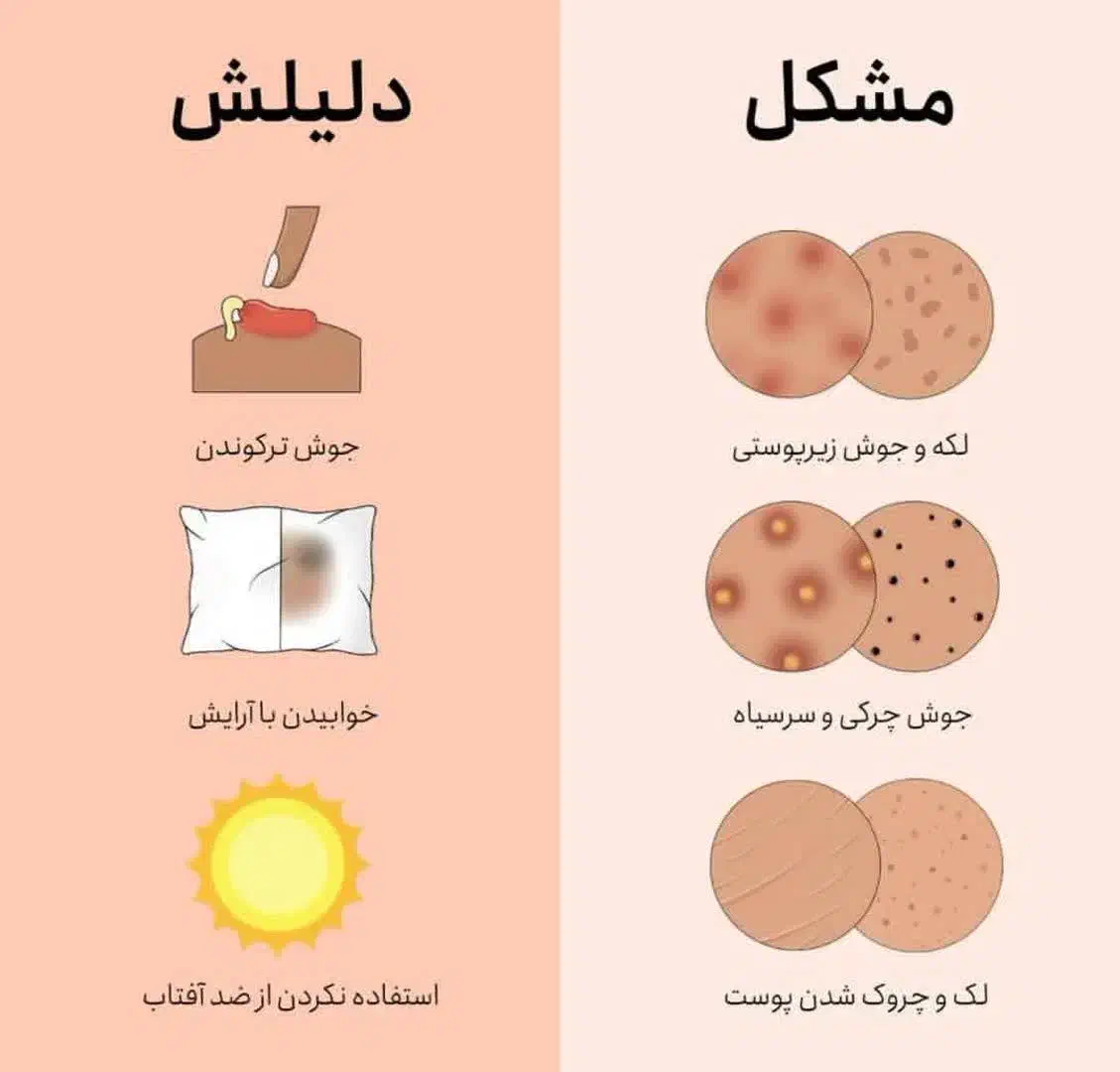 تخفیف ویژه روز جهانی دختر|آرایشی، بهداشتی، درمانی|تربت‌حیدریه, آبشار|دیوار