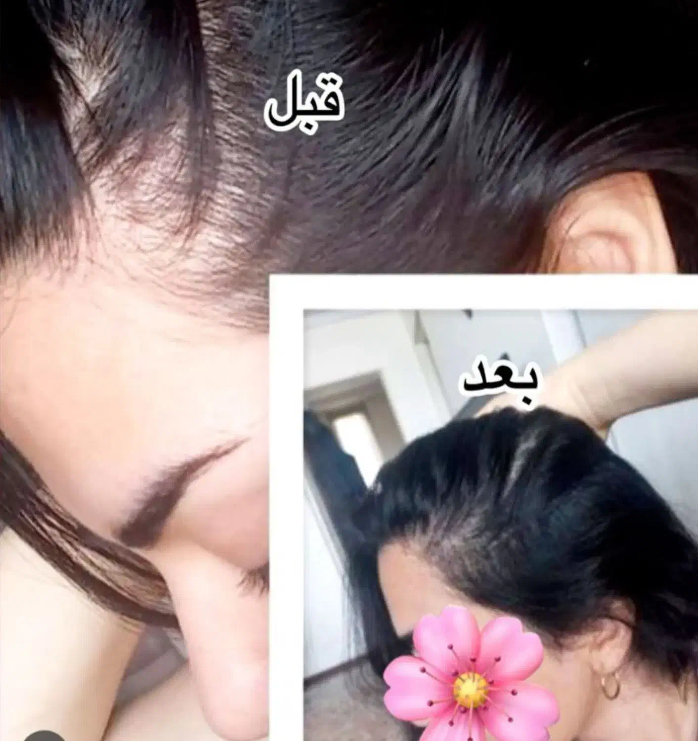 .پک گیاهی تقویتی و ضد ریزش و رویش مجدد مو|آرایشی، بهداشتی، درمانی|چالدران, |دیوار