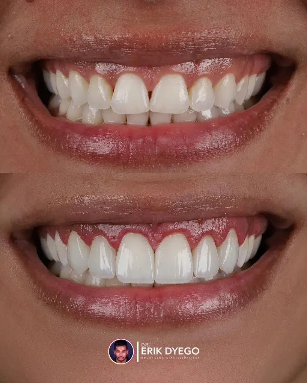 کامپوزیت/لمینیت/ایمپلنت/عصب کشی،و درمانی اقساطی|خدمات آرایشگری و زیبایی|مشهد, جنت|دیوار