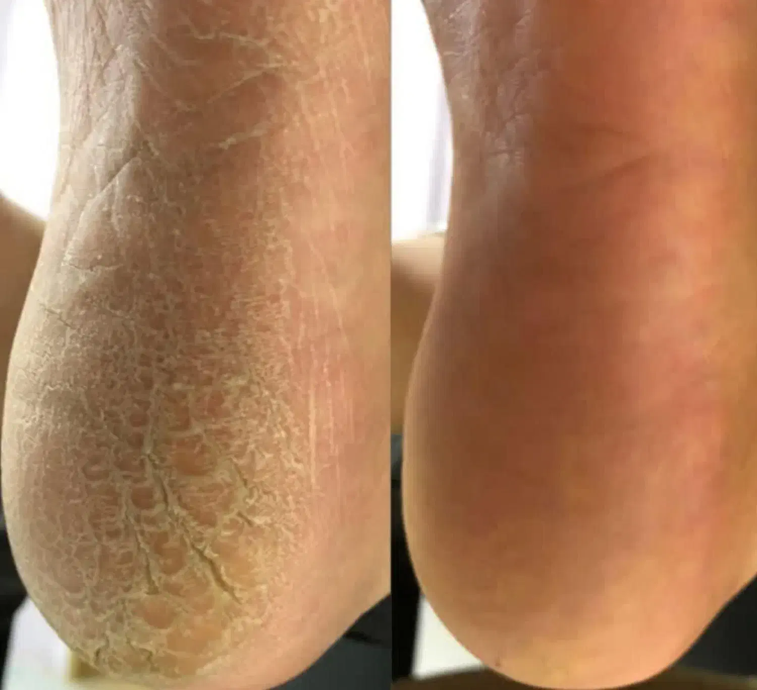 آموزش وخدمات تخصصی پدیکور واسپا درجشنواره پاییزه|خدمات آموزشی|زنجان, |دیوار