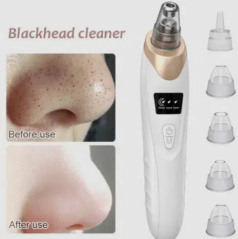 یک دستگاه میکرودرم مارک HY9 به فروش میرسد|آرایشی، بهداشتی، درمانی|بندرعباس, |دیوار