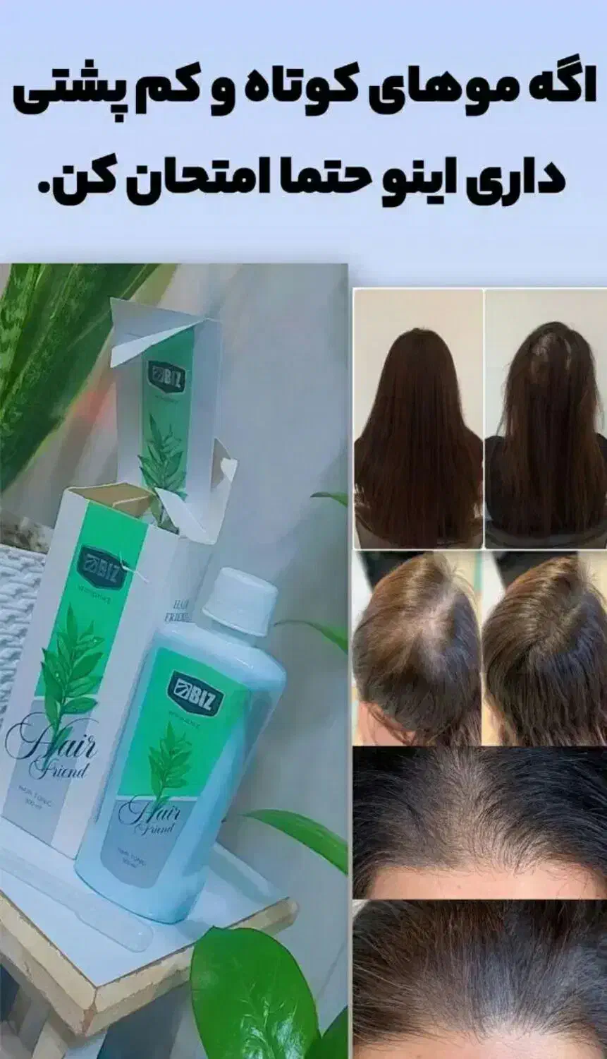 درمان ریزش موی سر|مواد شوینده و دستمال کاغذی|تبریز, |دیوار