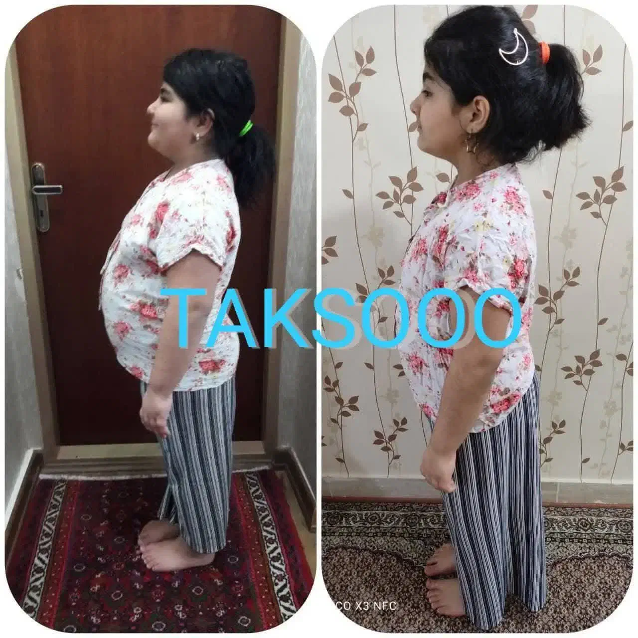 خیلی راحت بدون رژیم سخت چربیسوزی کن|آرایشی، بهداشتی، درمانی|سبزوار, دانشگاه آزاد|دیوار