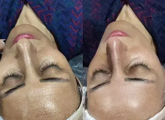 بمب تخفیفات فیشال و خدمات پوستی شروع قیمت از ۱۸۸|خدمات آرایشگری و زیبایی|شیراز, فرگاز|دیوار