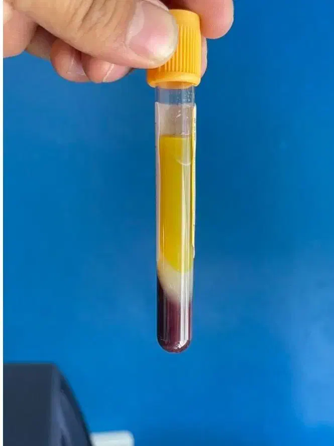 پی آر پی حجامت امبدینگ طب سوزنی زالو بادکش|خدمات آرایشگری و زیبایی|اصفهان, فروردین|دیوار