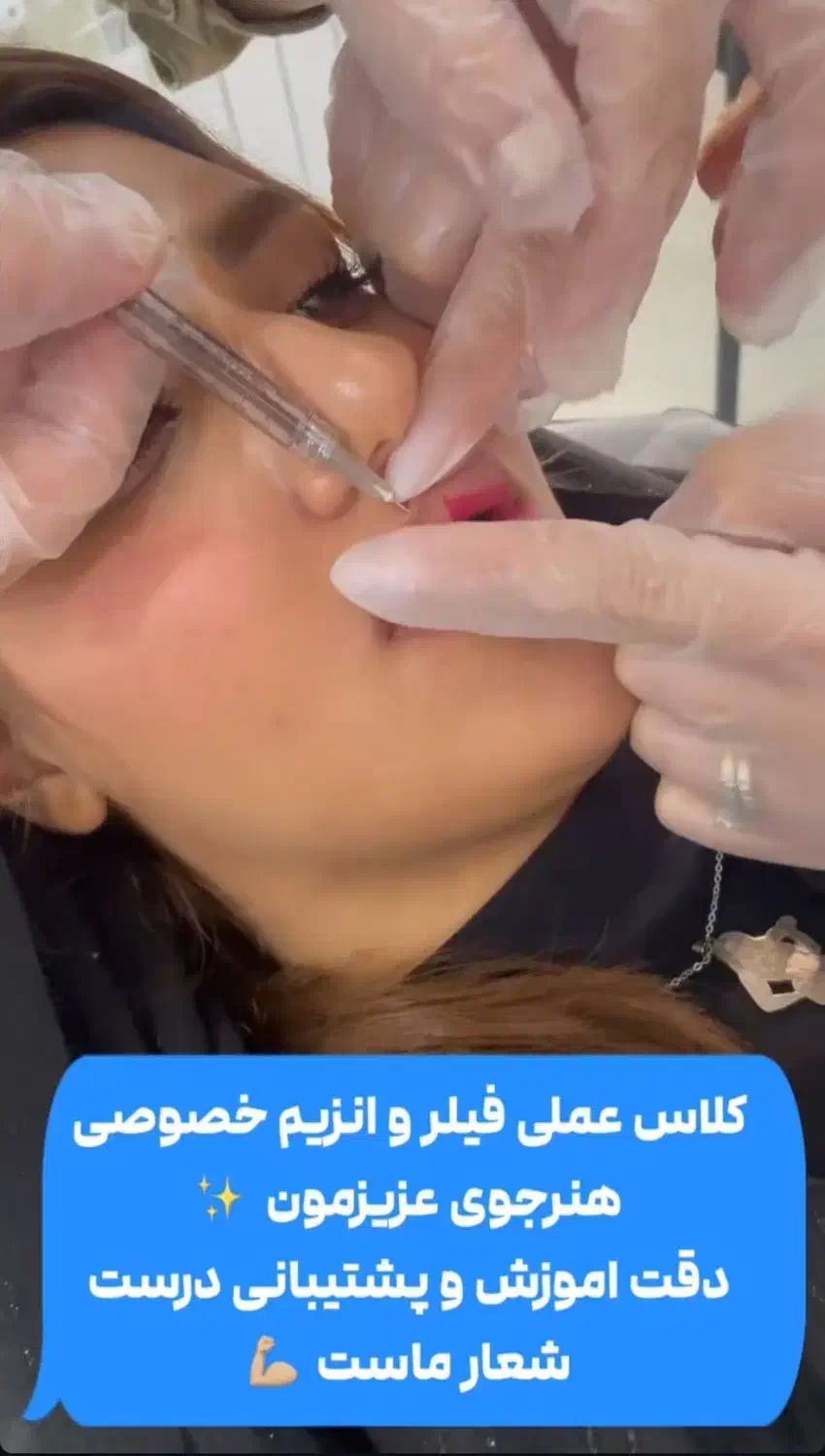کلاس آموزش تخصصی فیلر،بوتاکس،لب روسی،مزوتراپی و نخ|خدمات آموزشی|تهران, مشیریه|دیوار
