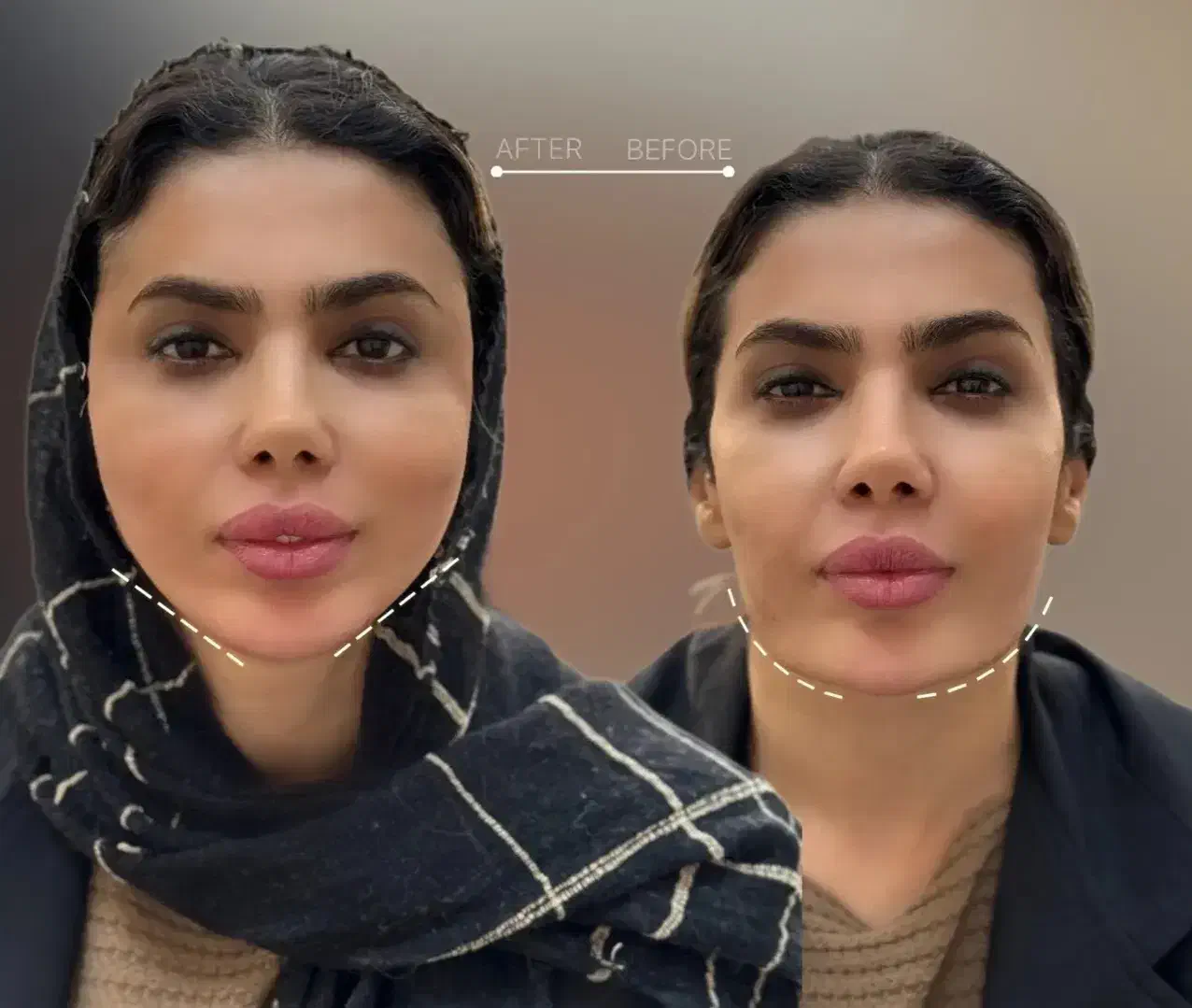 تخفیف روز مادر|خدمات آرایشگری و زیبایی|رشت, بوسار|دیوار