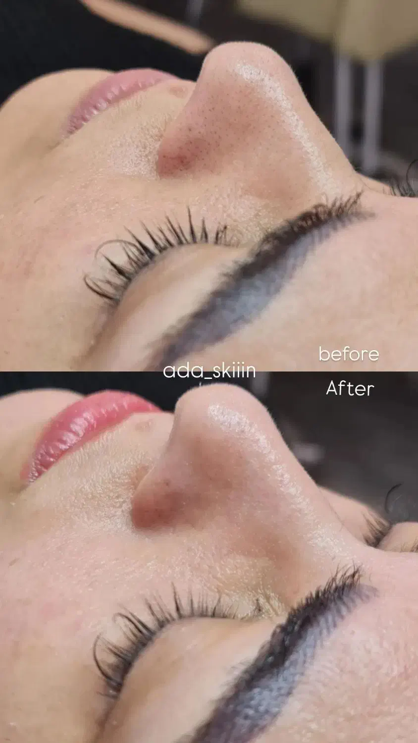 فیشال تخصصی با تخفیف ویژه مدت محدود|خدمات آرایشگری و زیبایی|لاهیجان, مهرگان|دیوار