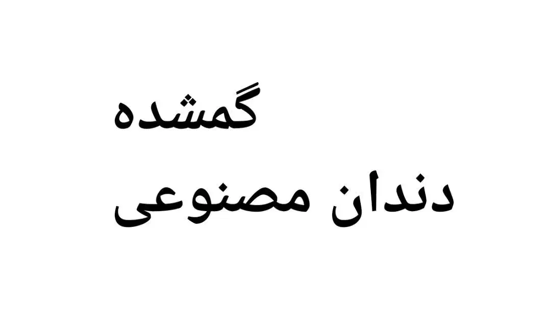 گمشده|اشیا|علیآباد کتول, |دیوار