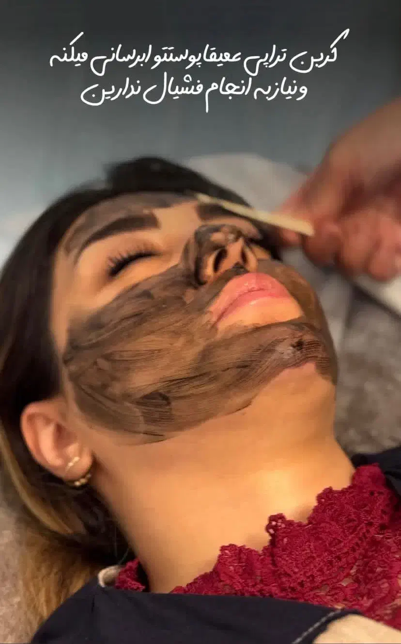 لیزر سفیدی و ریمو تتو و پلینیگ کربن(رفع لک صورت)|آرایشی، بهداشتی، درمانی|مشهد, هفت تیر (آب و برق)|دیوار