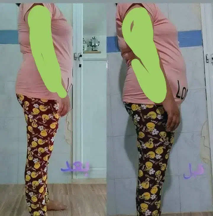 چربی سوزی شکم پهلو طبیعی|آرایشی، بهداشتی، درمانی|قائن, |دیوار