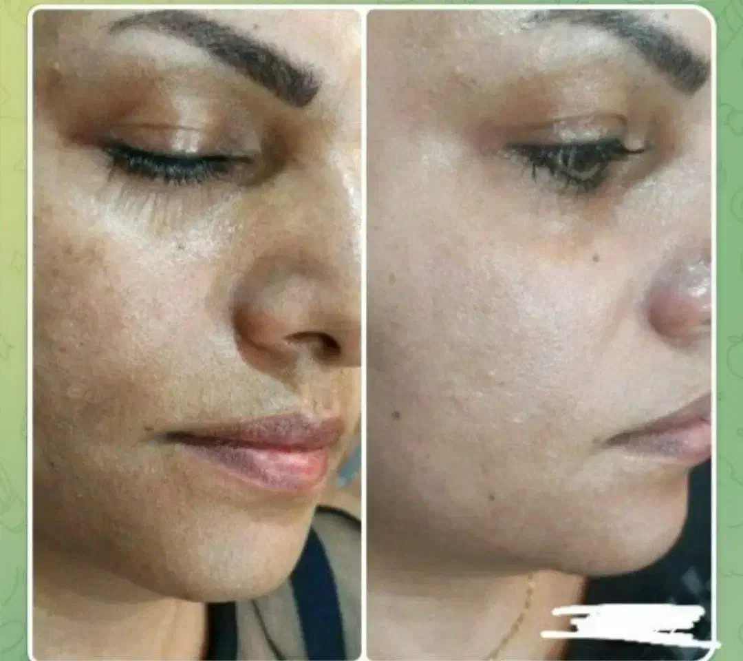 توی ۳ روز سفید برفی و بلوری شو|خدمات آرایشگری و زیبایی|امیدیه, |دیوار