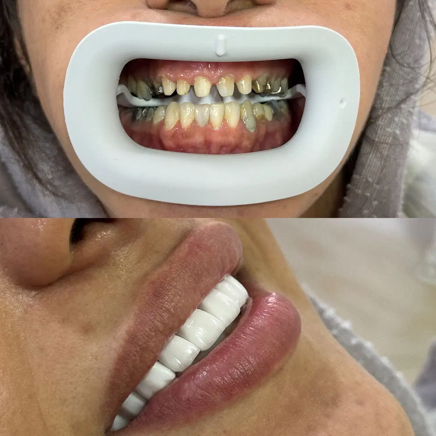 جشنواره دندانپزشکی (تمامی خدمات)|خدمات آرایشگری و زیبایی|اصفهان, لنبان|دیوار