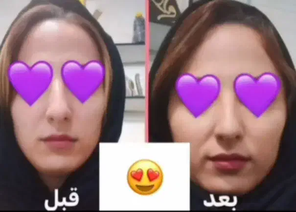 جوانه گندم|آرایشی، بهداشتی، درمانی|تهران, تهرانسر غربی|دیوار