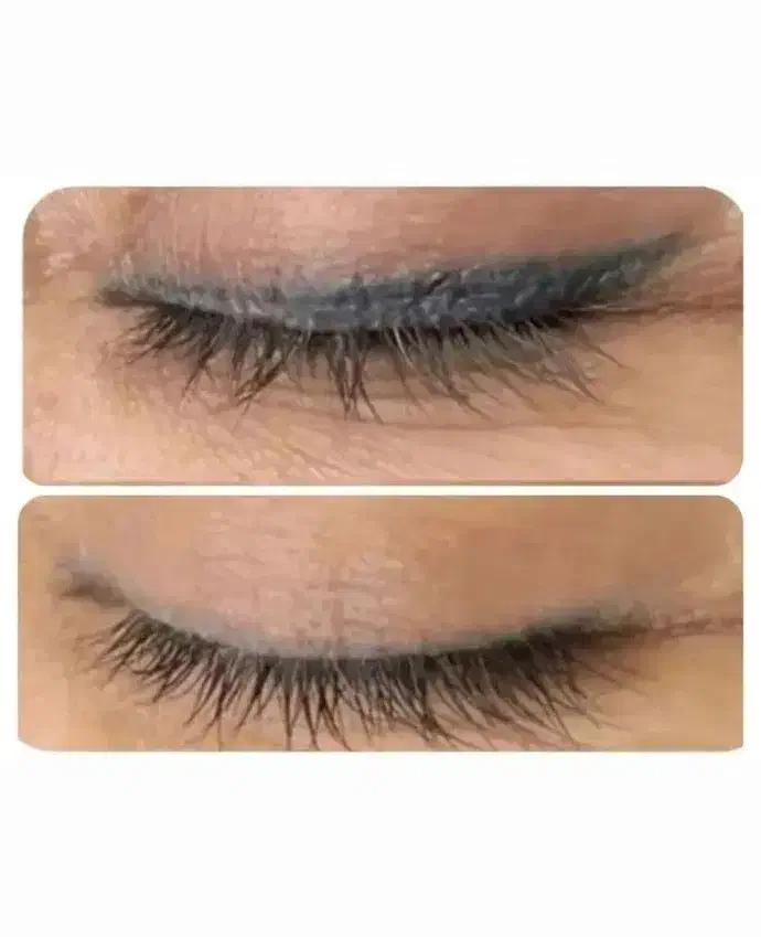 ریموو تاتو، پاک کردن تتو تخصصی کرج، البرز|خدمات آرایشگری و زیبایی|کرج, عظیمیه|دیوار