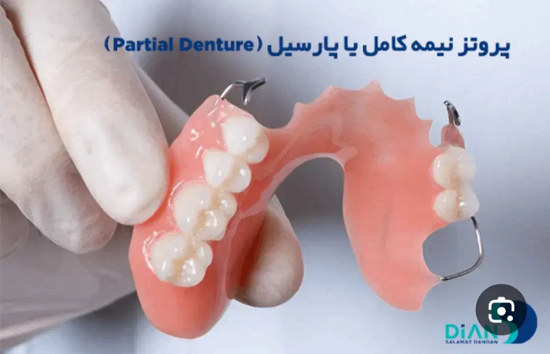 دندانسازی امیر دنت|آرایشی، بهداشتی، درمانی|اردبیل, |دیوار