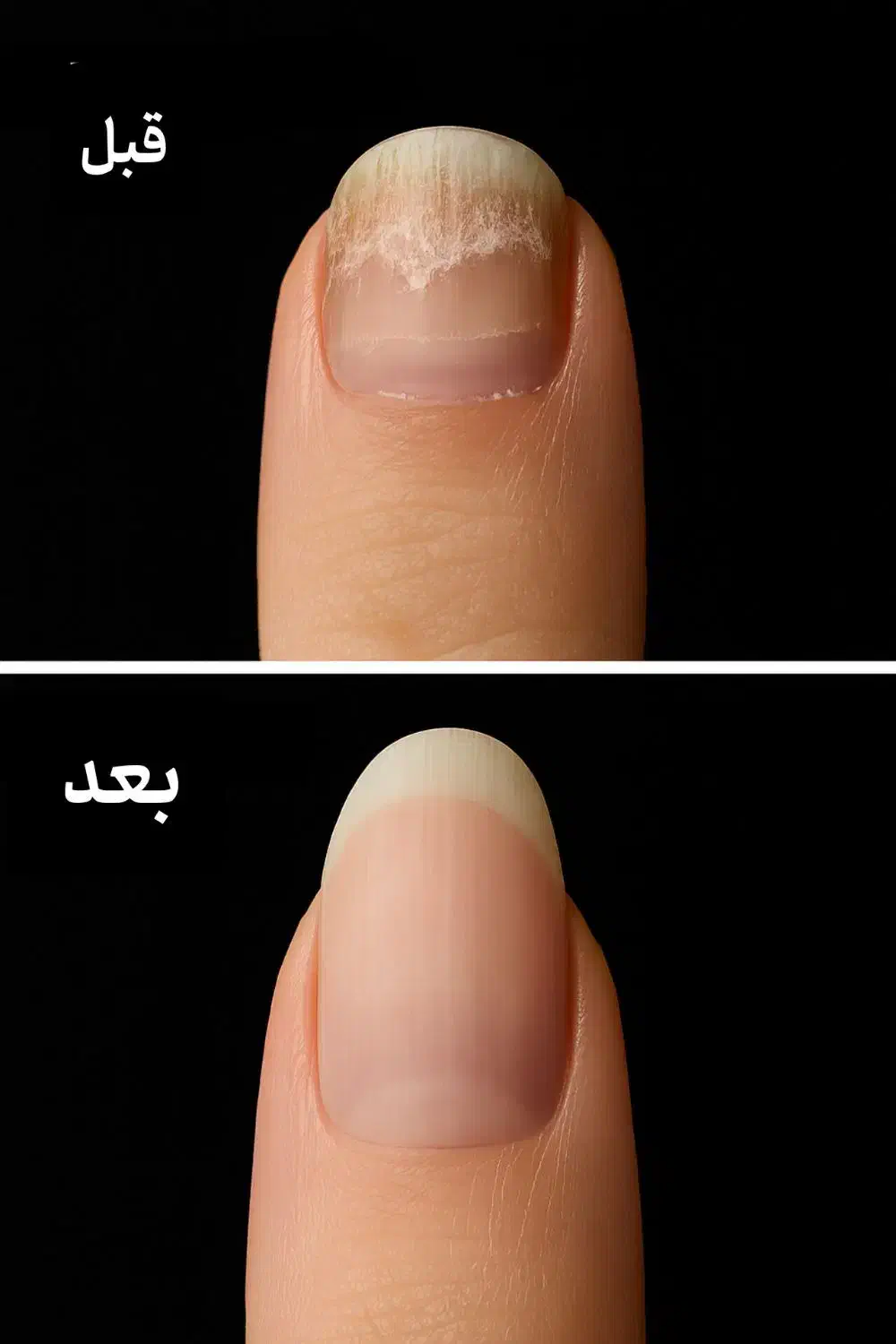 با کاشت ناخن خداحافظی کن|آرایشی، بهداشتی، درمانی|رشت, پل تالشان|دیوار