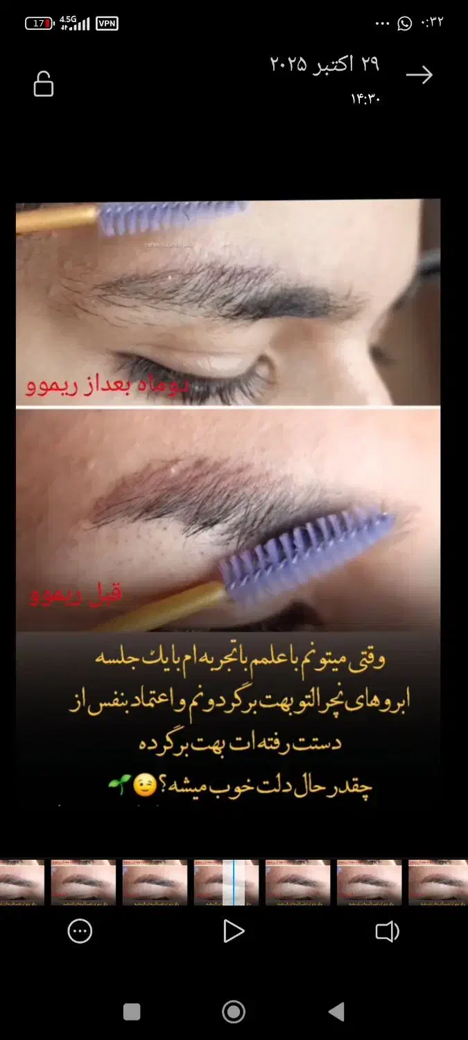 پاک کردن یا ریموو تک جلسه ای صورت و بدن|خدمات آرایشگری و زیبایی|آبدانان, |دیوار