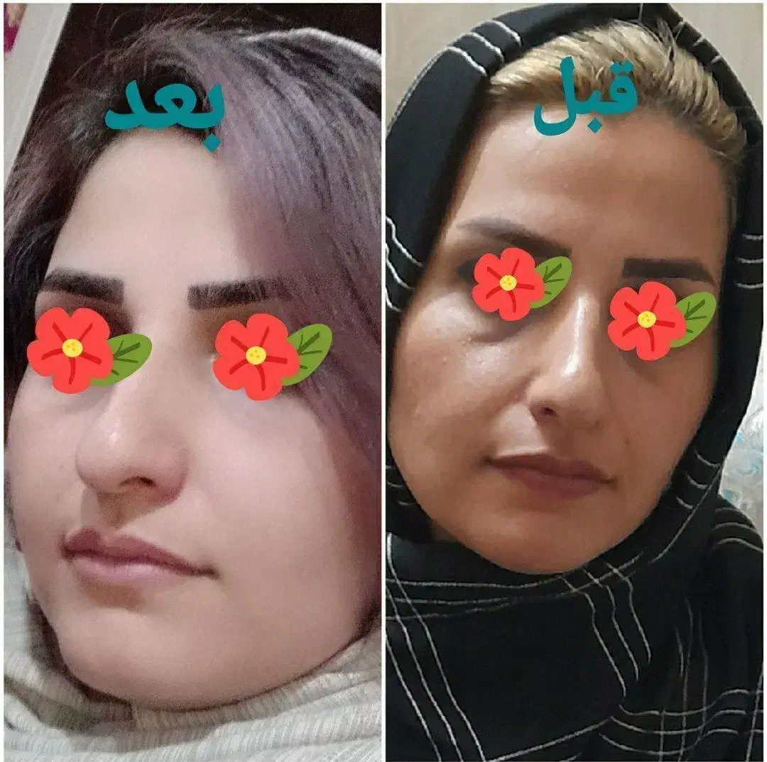توی ۳ روز سفید برفی و بلوری شو|خدمات آرایشگری و زیبایی|امیدیه, |دیوار