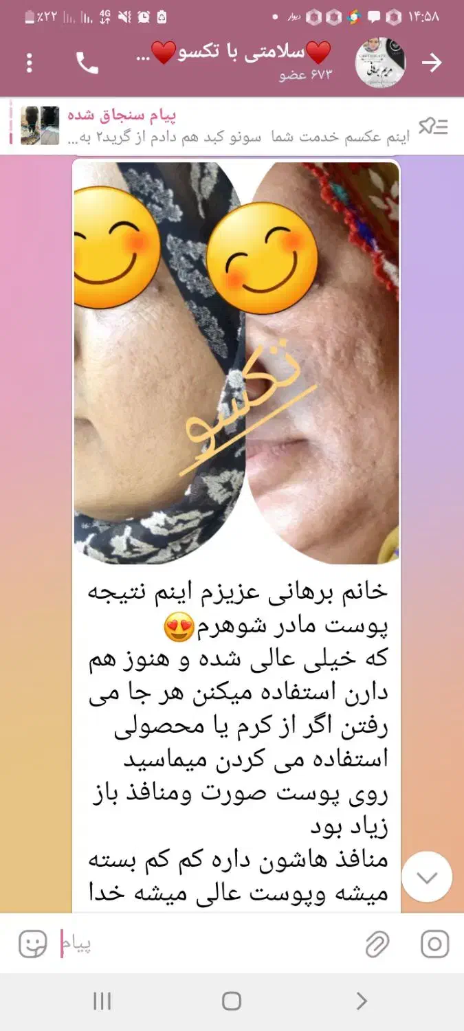 لاغری، کیست و تنبلی تخمدان، کبدچرب، پوست ومو|آرایشی، بهداشتی، درمانی|مشهد, خواجه ربیع|دیوار