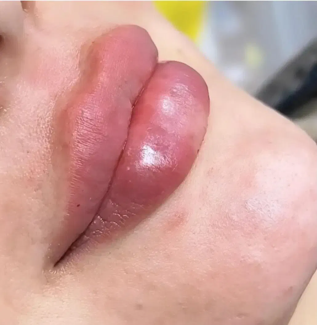 تزریق ژل و بوتاکس تخصصی|خدمات آرایشگری و زیبایی|اندیشه, اندیشه فاز ۱|دیوار