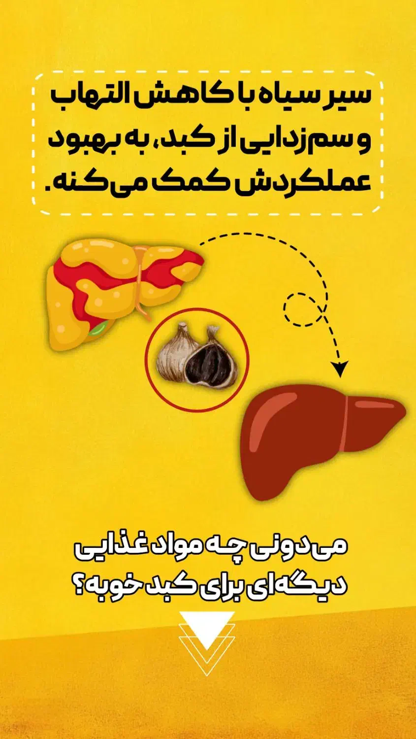 درمان خانگی کبد چرب|آرایشی، بهداشتی، درمانی|سیرجان, |دیوار