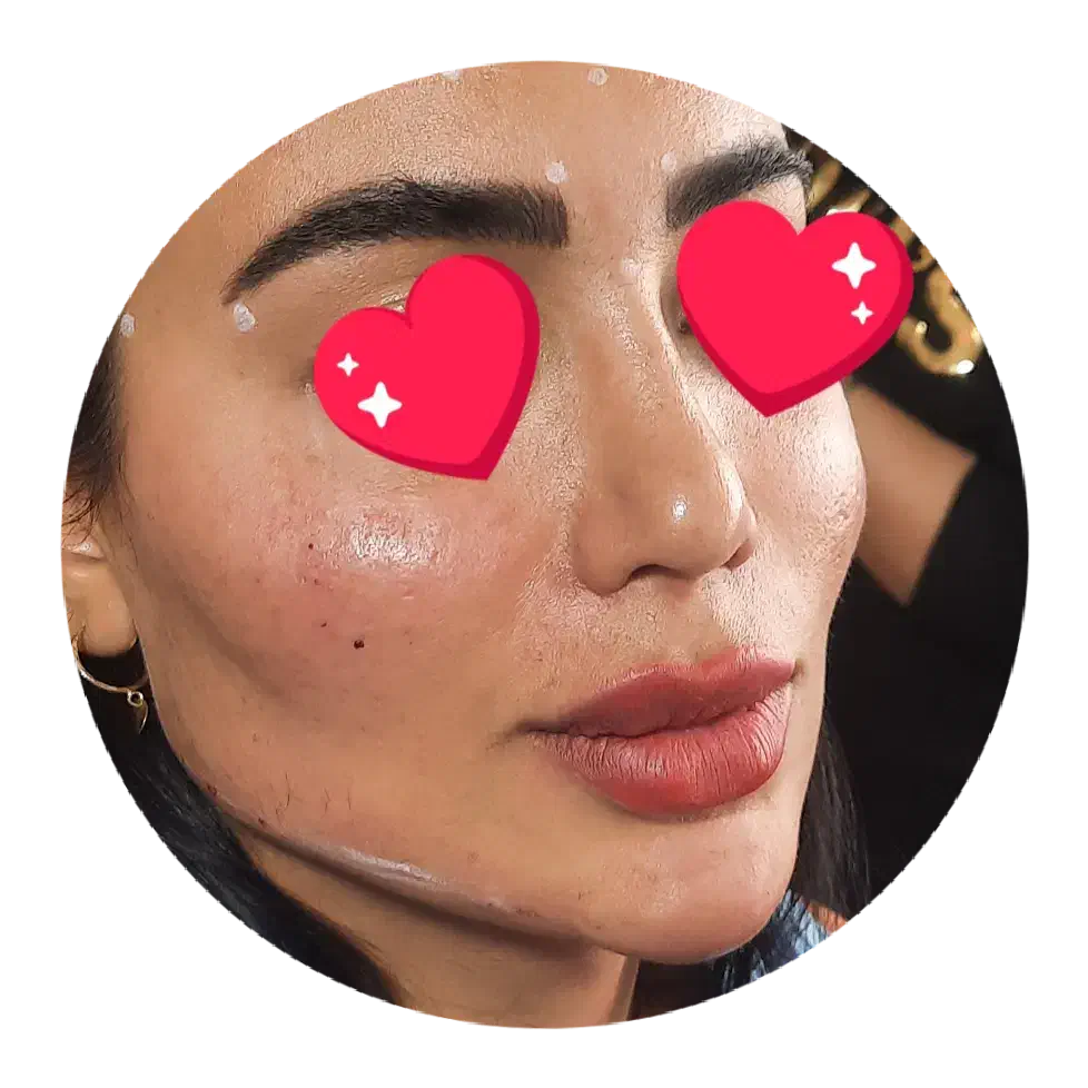 جشنواره بوتاکس مصپورت ۶۵۰فیلر ۶۹۰ فقط تا آخر آبان|خدمات آرایشگری و زیبایی|اصفهان, شمس آباد|دیوار