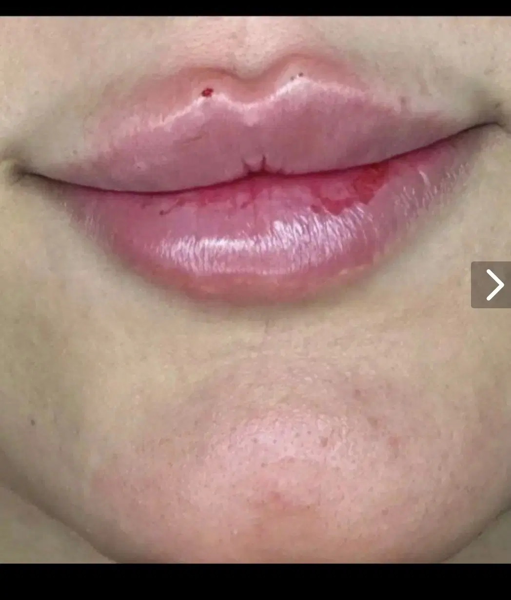 بوتاکس و ژل فیلر|خدمات آرایشگری و زیبایی|فردیس, سرحدی|دیوار