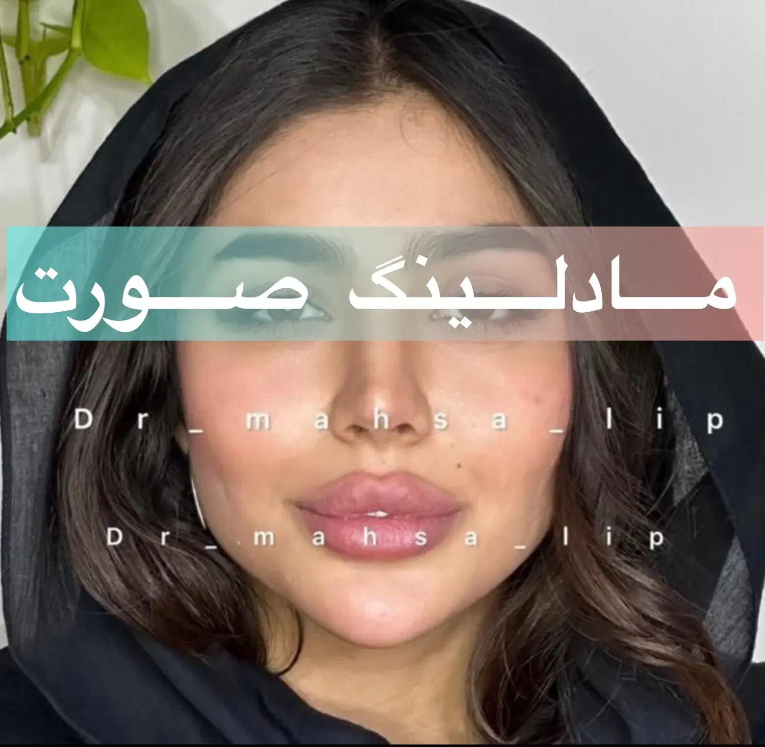 کلینیک تخصصی تزریق فیلر/ژل لب روسی/مادلینگ نچرال|خدمات آرایشگری و زیبایی|تهران, الهیه|دیوار