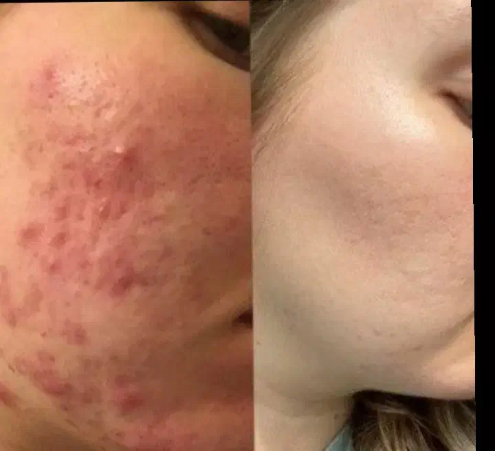 کرم وی ای پی اصل صدرصد تضمینی و بدون بازگشت|آرایشی، بهداشتی، درمانی|یاسوج, |دیوار