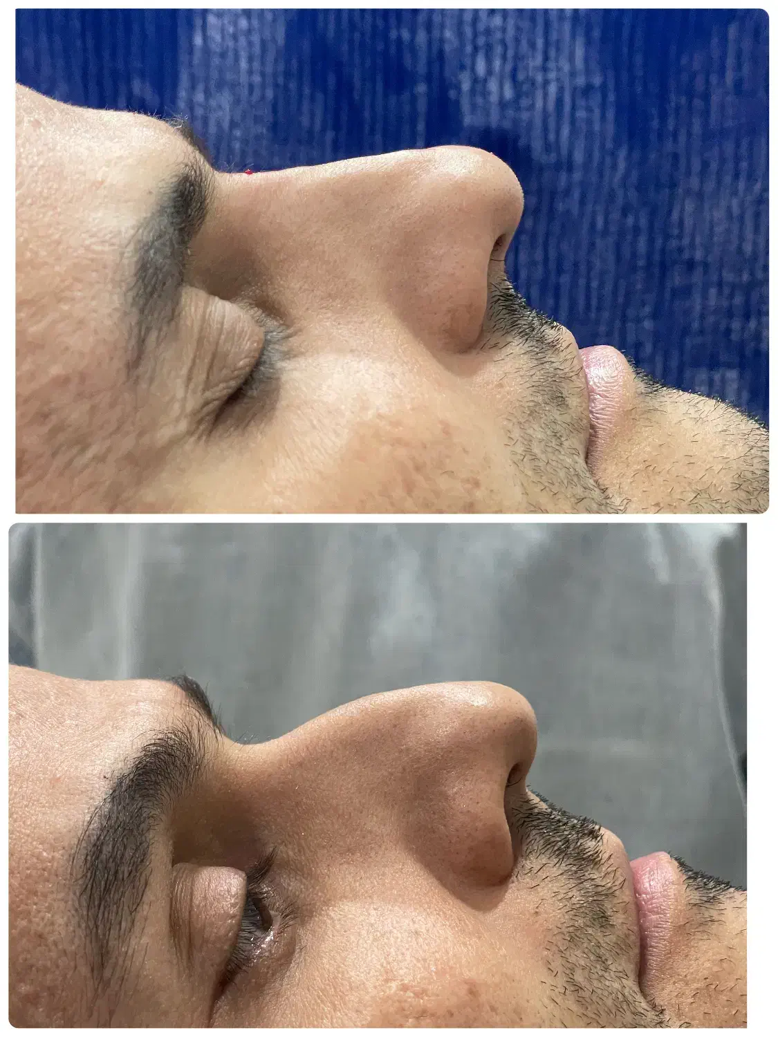 اصلاح فرم|خدمات آرایشگری و زیبایی|سنندج, |دیوار