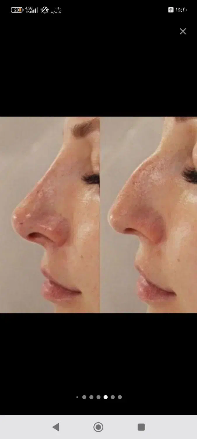 تزریق ژل،بوتاکس درمکانی مستقل بارعایت اصول بهداشتی|خدمات آرایشگری و زیبایی|زاهدان, |دیوار