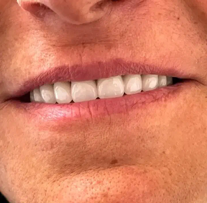 دندان سازی|پزشکی|ارومیه, |دیوار