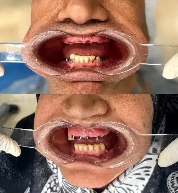 فستیوال اقساطی دندان پزشکی خدمات دندانپزشکی|خدمات آرایشگری و زیبایی|اصفهان, دشتستان|دیوار